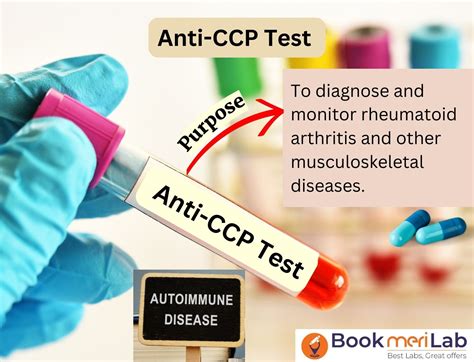 anti ccp test price